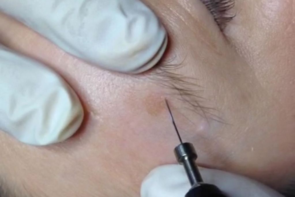 Divaverde.de - Anwendungen für Ihre Schönheit – Pigmentflecken