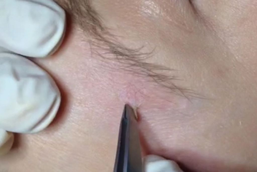 Divaverde.de - Pigmentflecken