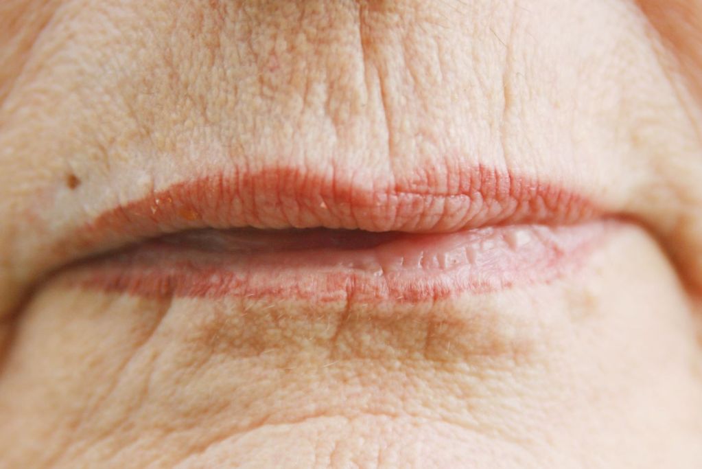 Divaverde.de - Anwendungen für Ihre Schönheit – Falten RF-Boost